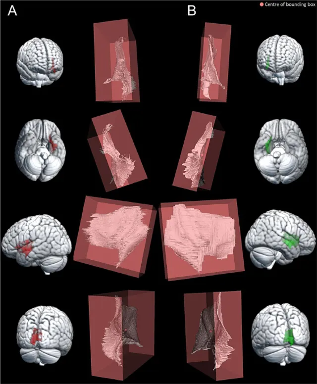 Claustrum label of the human brain