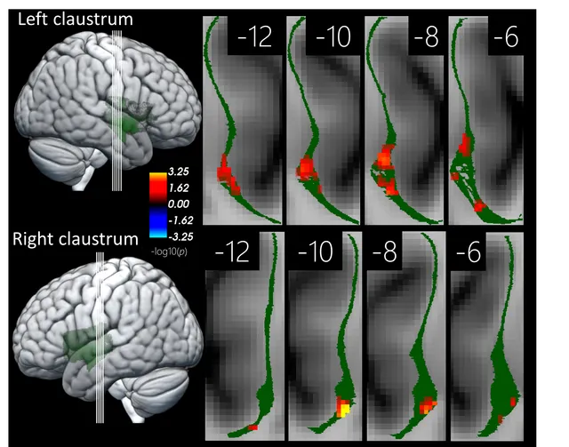 Visual zone of the human claustrum